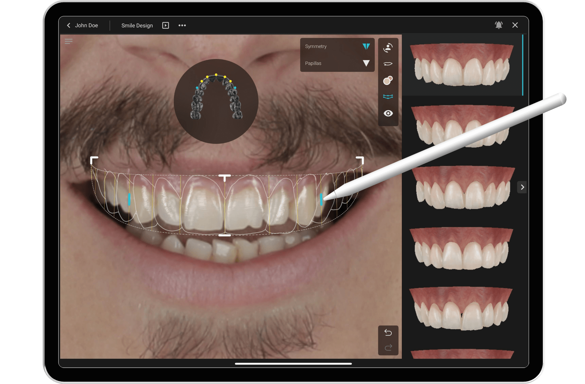 SmileCloud